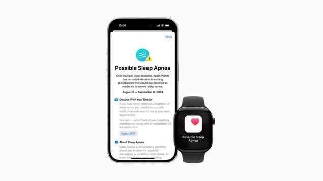 Обнаружение апноэ Apple Watch Series 10
