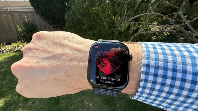 Приложение ЭКГ на Apple Watch